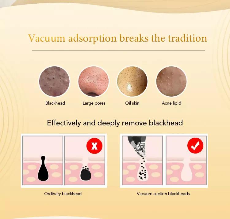 Facial Pore Cleaner Comedo Acne Suction Blackhead Remover Vacuum