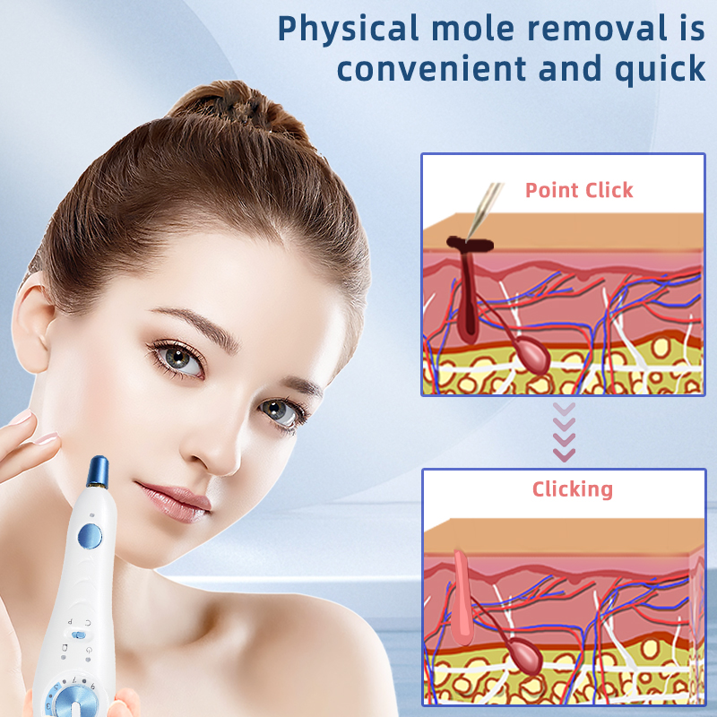 professional skin care device plasma pen for face lift removal pen plasma freckle mole remover machine