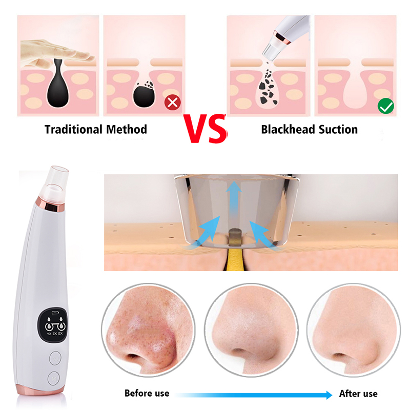 Nose Vacuum Pore Cleaner Beauty Skin Care Tools For Remove Facial Blackheads Usb Cable Blackhead Remover