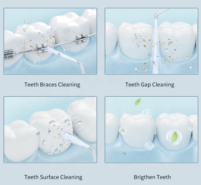 Household Electric Dental Ultrasonic Scaler For Oral Cleaning To Remove Dental Calculus Dental Scaler Portable Water Flo