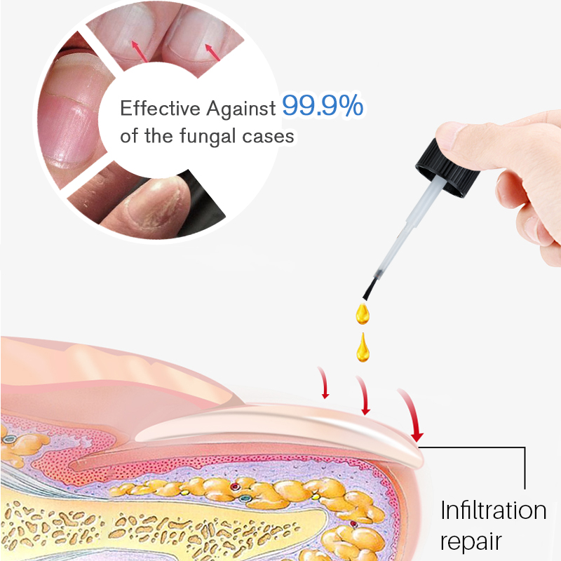 Lanthome natural organic pure treatment nourishing anti fungus smooth and hydrates nail care product nail repair serum e