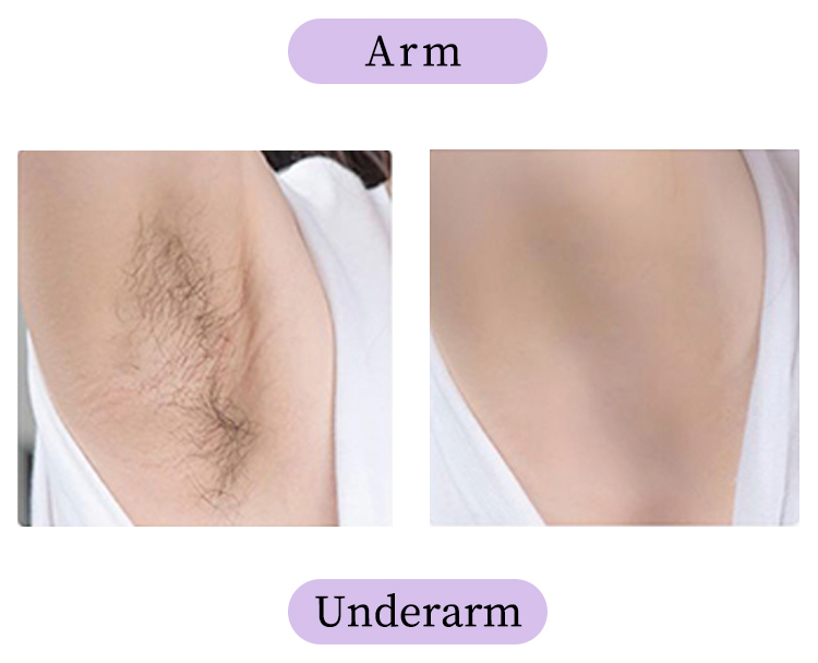 Female Intimate Depilatory Organic Hair Removal Cream
